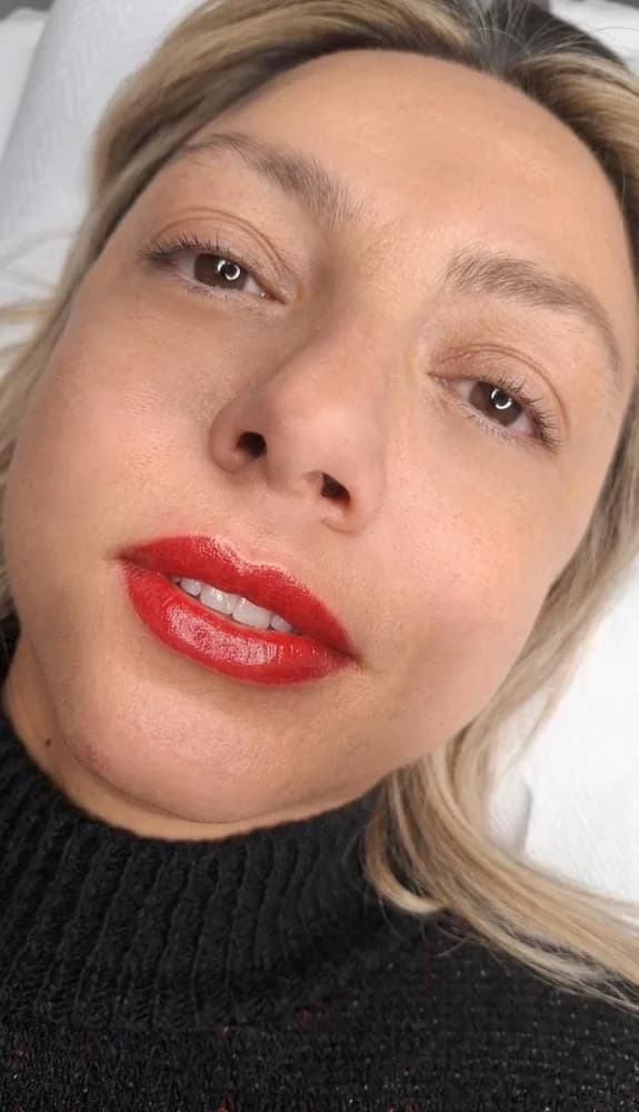 Valentina Bonacci - lip blush labbra prima e dopo dermopigmentazione - Dopo