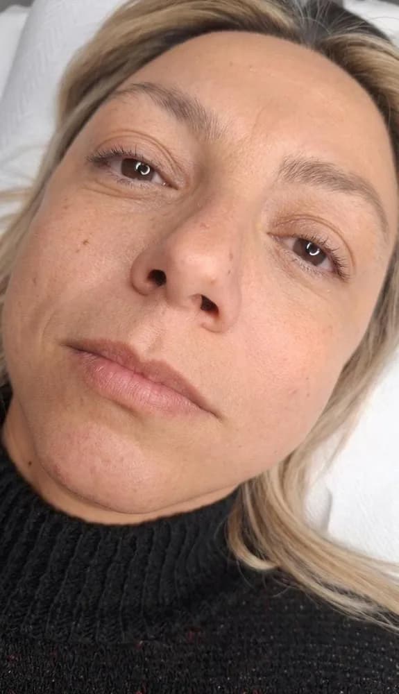 Valentina Bonacci - lip blush labbra prima e dopo dermopigmentazione - Prima